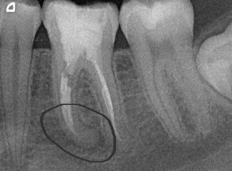 Nord Vest Dental - cabinet stomatologic