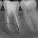 Nord Vest Dental - cabinet stomatologic